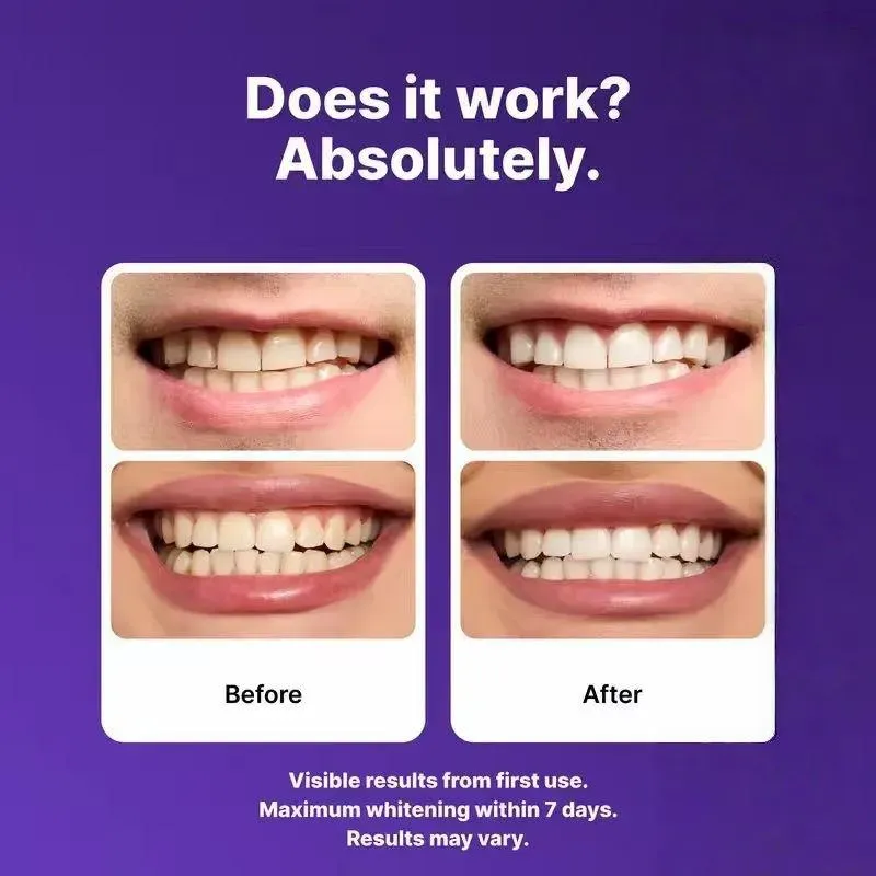 Whitening strips, home use, antibacterial, non-toxic, safe for protecting tooth enamel - gentle and non-irritating - peroxide-free