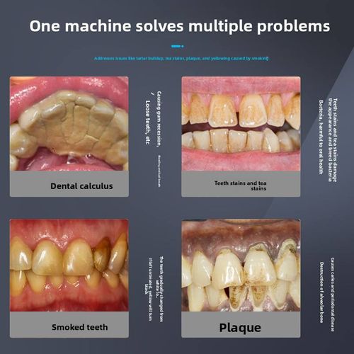 Sonic Electric Toothbrush with Soft Bristles Magnetic Levitation Rechargeable Tartar Remover Teeth Whitening Stain Removal