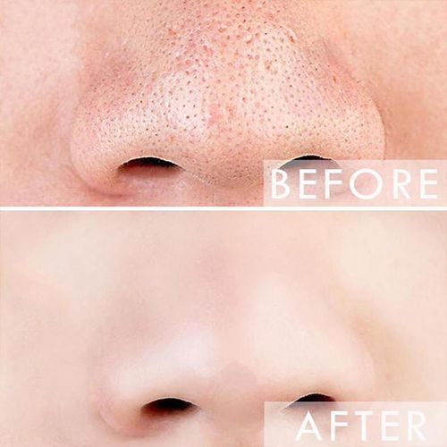 Golden Cream Mask