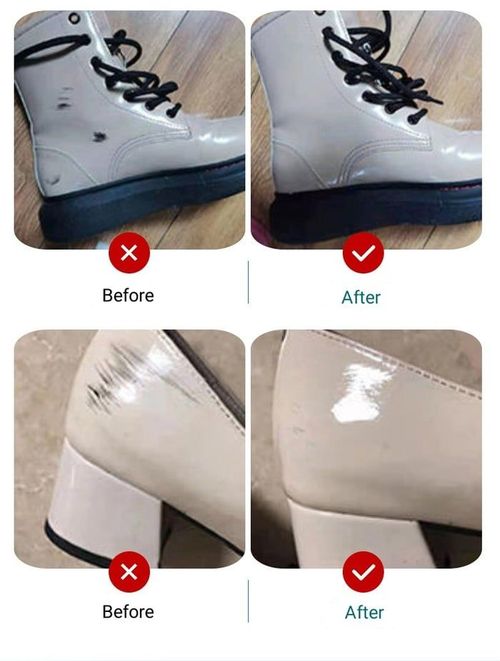 🔥Shoes Whitening Cleaner