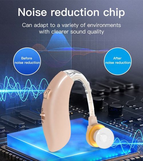 Compact hearing aid: enhances sound, fits discreetly, and has simple controls. Lightweight, comfortable, perfect for daily activities to boost hearing