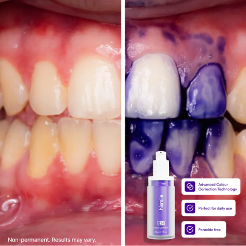 Colour Corrector - Tooth Stain Concealer, Temporary Brightening Booster, Purple Toothpaste, Colour Correcting