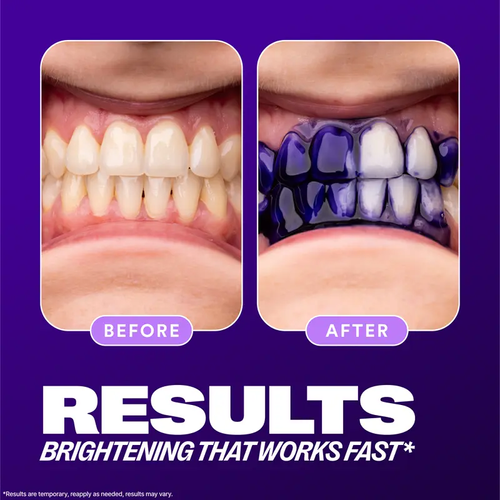 Colour Corrector - Tooth Stain Concealer, Temporary Brightening Booster, Purple Toothpaste, Colour Correcting