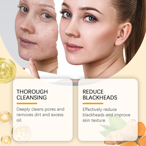 Most Popular Korean Skincare Turmeric Kojic Acid Anti Acne Whitening Foaming Skin Face Cleans Facial Foam Cleanser with Brush
