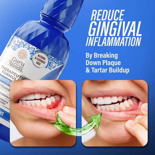 Anti-Gingivitis Oral Rinse with 0.05% CPC, Alcohol & Fluoride Free Therapeutic Mouthwash for Plaque Removal, Tartar Control & Healthy Gums, Wild Mint, 16 oz