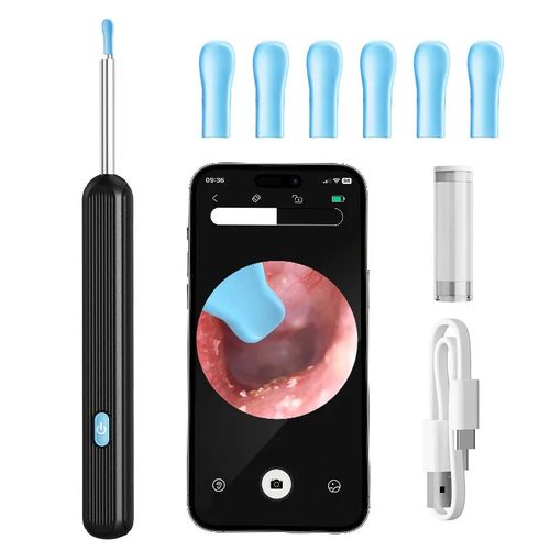 HD Ear Camera Cleaner – 1296P Precision with LED Lights & USB-C Charging