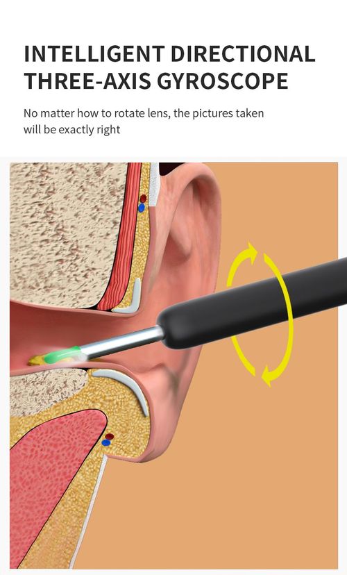 Visual Ear Scoop Cordless Cleaning Endoscope HD Ear Pickers