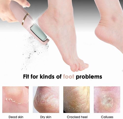 Electric Callus Pedicure Foot Grinder