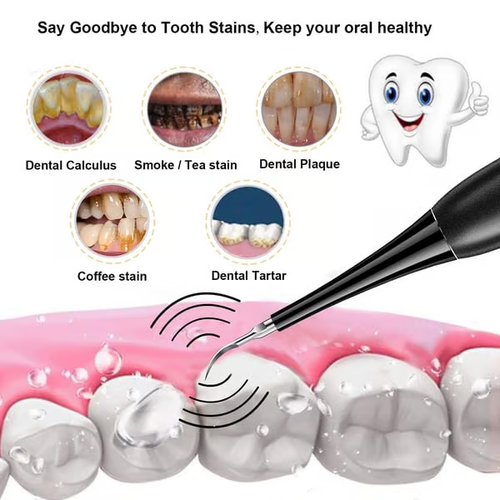 Electric Ultrasonic tooth cleaner