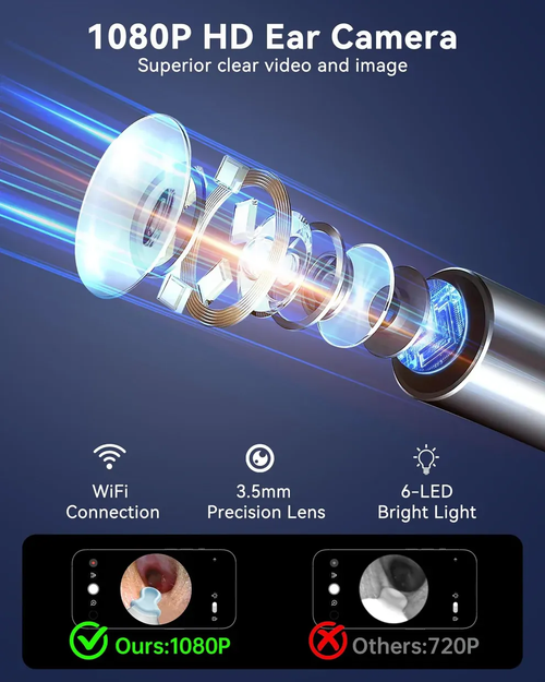 🔥Hot Sale🔥Wireless Visual Earpick