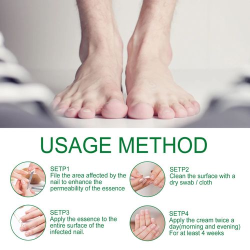 Ginger Nail Care Lotion Repair Hand And Foot Moisturizing