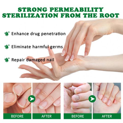 Ginger Nail Care Lotion Repair Hand And Foot Moisturizing