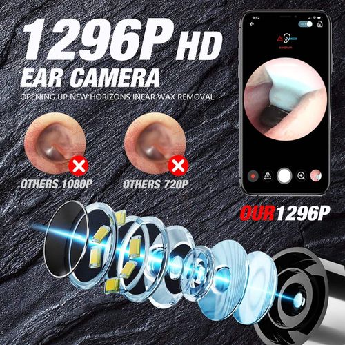 Ear Wax Removal with Camera1920p Wireless Ear Cleaner Multiple Interchangeable Heads
