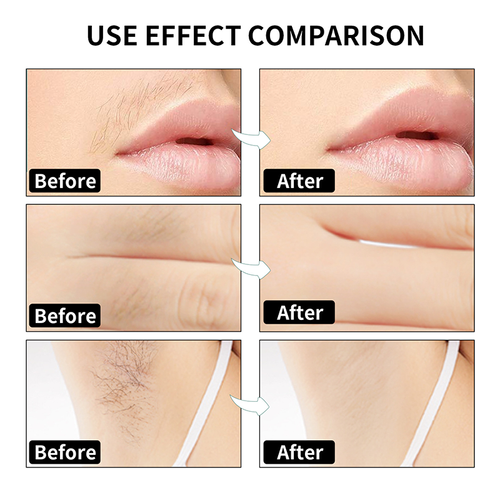 hair removal strips