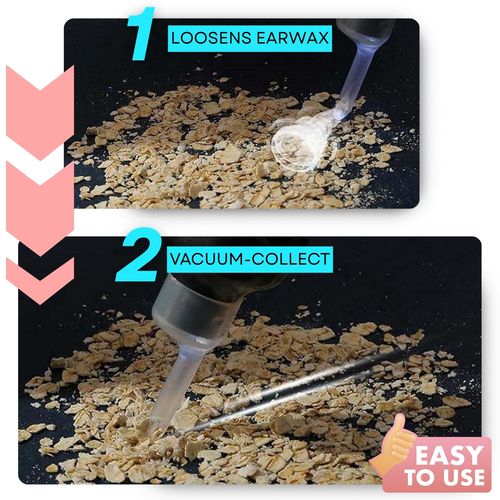 Earwax Vacuum