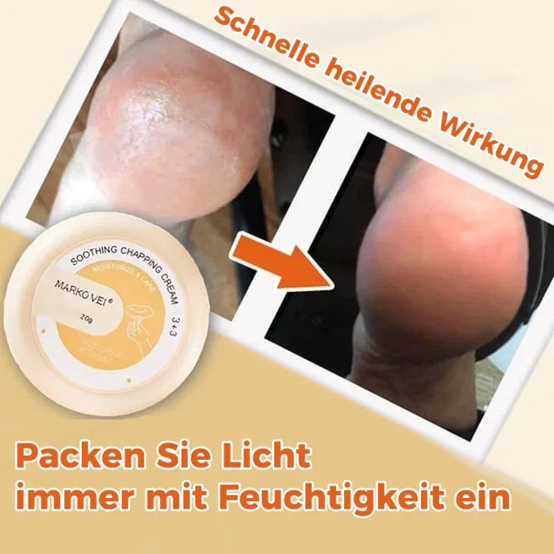 Buy 1 Get 2 !!!  Crack-resistant cream for skin🎁