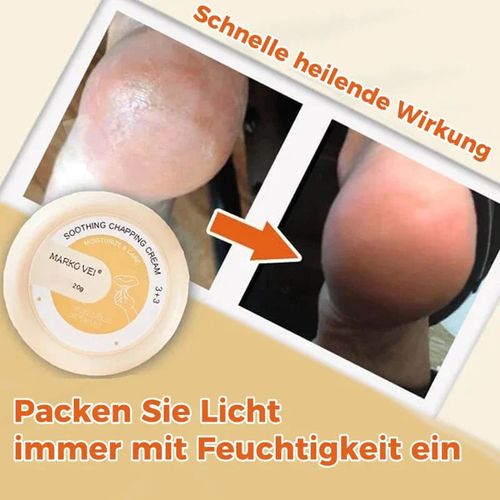 Crack-resistant cream for skin