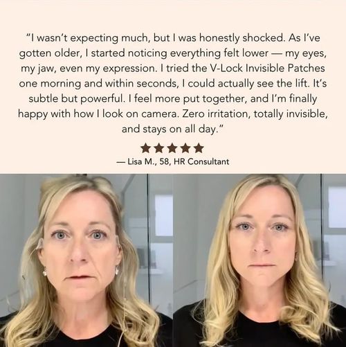 V-Lock Invisible Patches