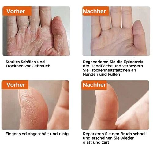 Crack-resistant cream for skin