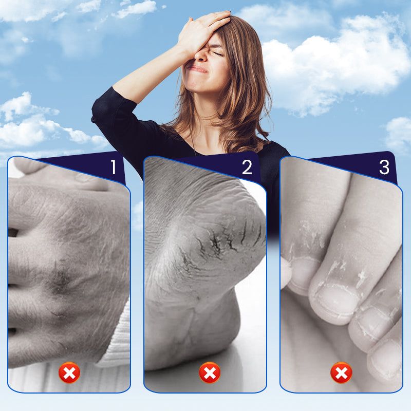 Restorative Patches for Cracked Skin – Hands and Feet