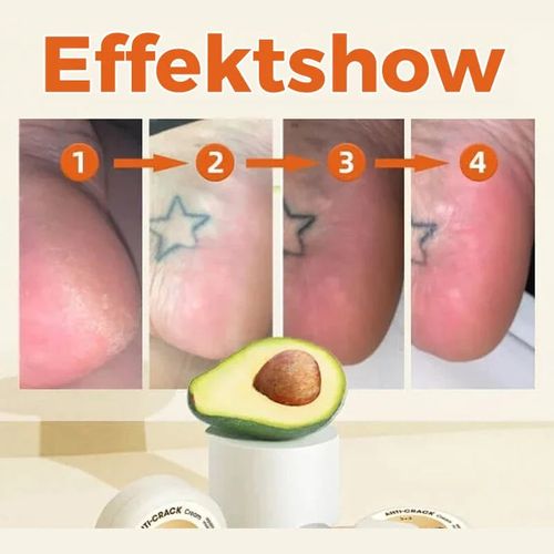 Crack-resistant cream for skin