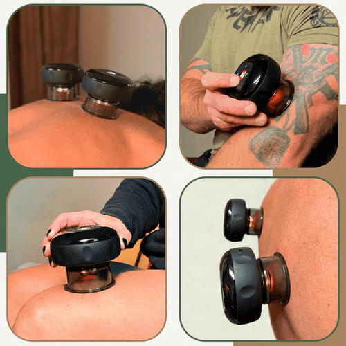Smart Cupping Massager