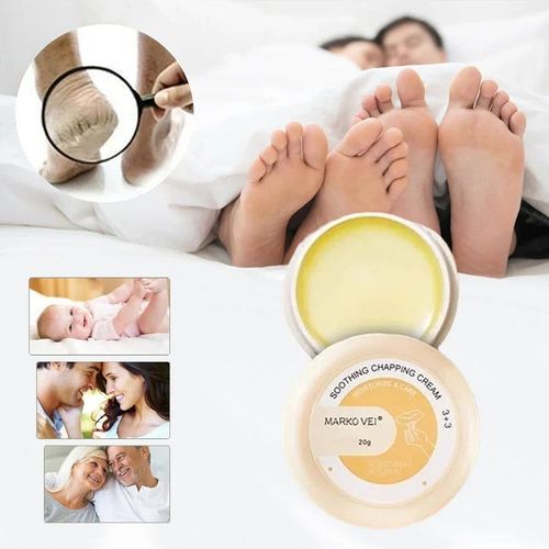 Crack-resistant cream for skin
