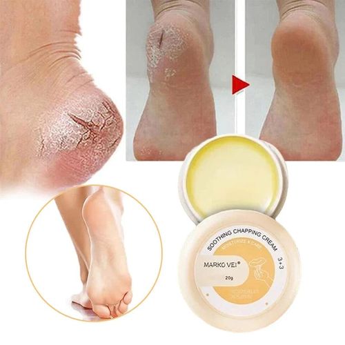 Crack-resistant cream for skin
