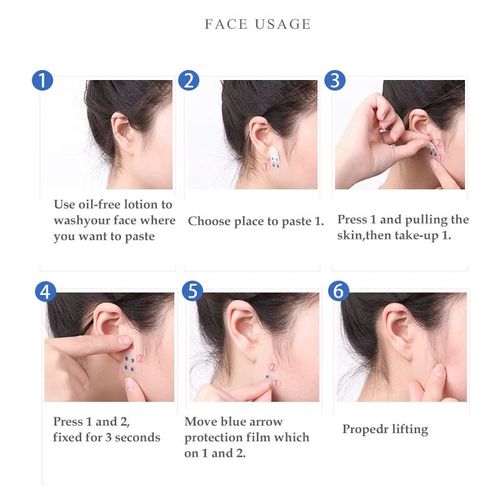 V-Lock Invisible Patches