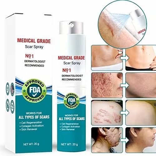 🔥Best Seller 🔥SayGoodbye to Scars Reveal Clearer, Smoother Skin With our powerful Scar Remover Cream