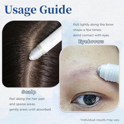 Aparthy's Advanced Hair Growth Roll-on Serum contains saw palmetto, rosemary, and pea extracts to help create thicker, fuller hair. It's refreshing and non-greasy, suitable for both men and women, and effectively prevents hair loss.