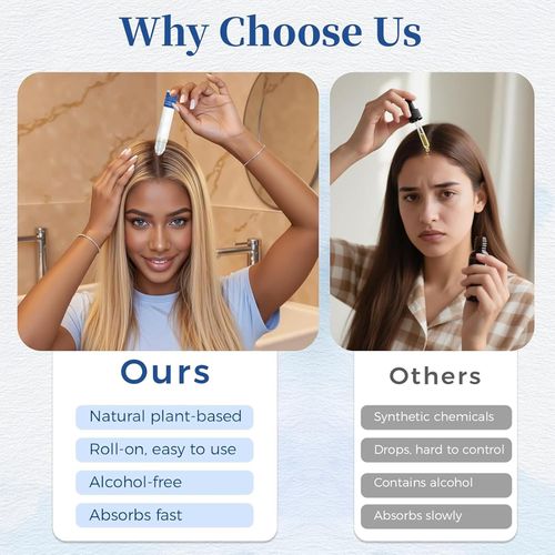 Aparthy's Advanced Hair Growth Roll-on Serum contains saw palmetto, rosemary, and pea extracts to help create thicker, fuller hair. It's refreshing and non-greasy, suitable for both men and women, and effectively prevents hair loss.