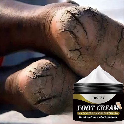 Creme Hidratante Intenso Creme de Reparo para Pés