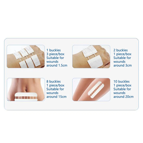 Wound Skin Closure Strips Postpartum Wound Repair Cosmetic Surgery Steri Strip Adhesive Medical Suture Free Surgical Tape