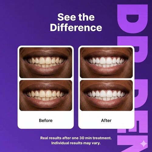 Teeth Strips