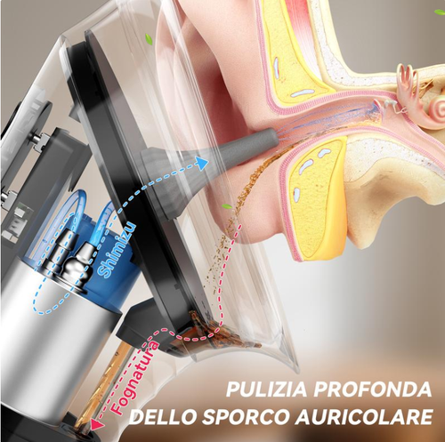 🔥Rechargeable Electric Ear Cleaning Kit