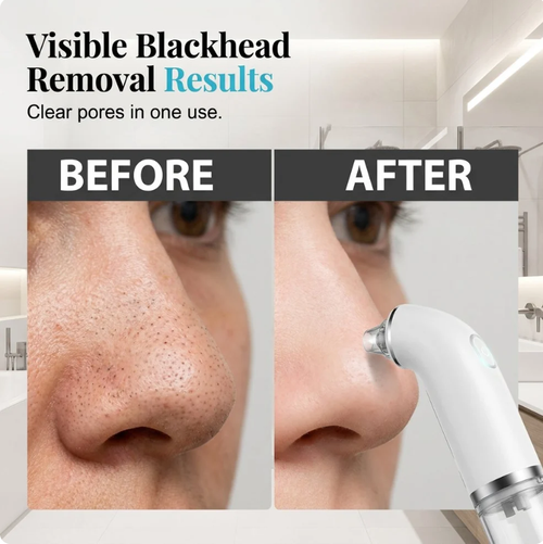Electric facial cleanser .Lifting and firming Deeppore cleansing
