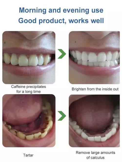 3PCS Stain Removing Probiotic Toothpaste