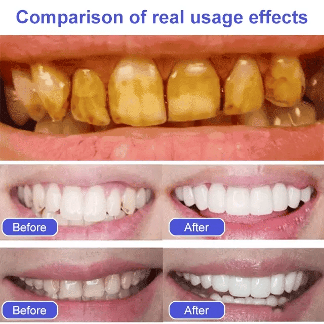 3PCS Stain Removing Probiotic Toothpaste