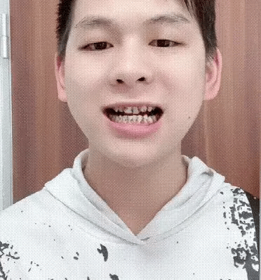 3PCS Stain Removing Probiotic Toothpaste