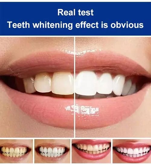 3PCS Stain Removing Probiotic Toothpaste