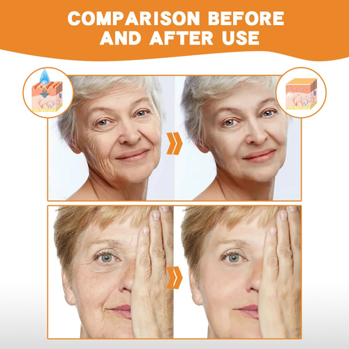 2026 New Instant Skin Essence Collagen Set