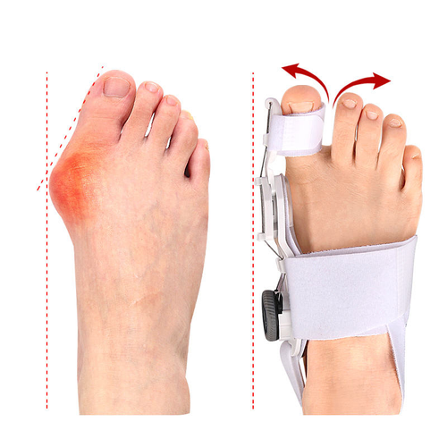 Toe Corrector