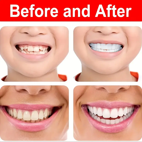 Buy one get two free Natural Denture Set | Food-Grade Resin | Comfort Fit for Men & Women