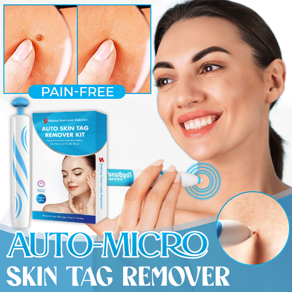 Auto Micro Skin Tag Remover - Natural, Chemical-free 🔥 Limited Time Discount 🔥