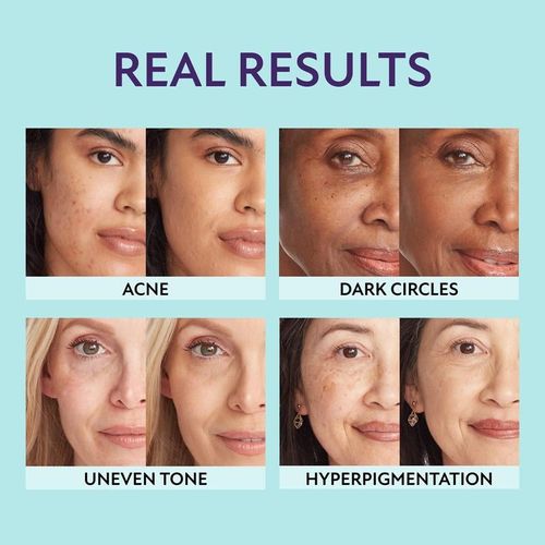 Soft Matte Cream Concealer