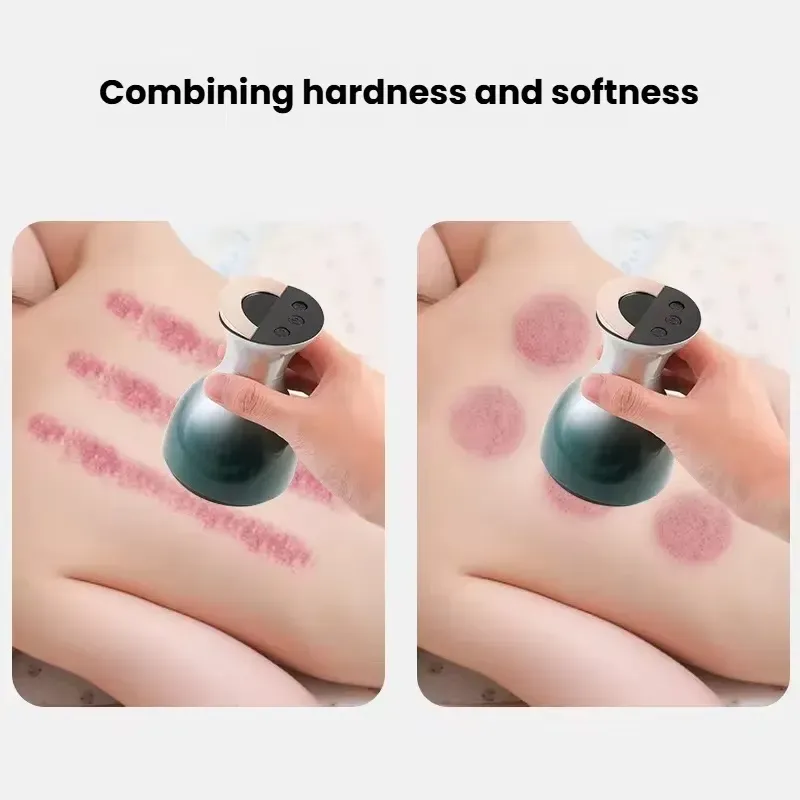 O exclusivo dispositivo de massagem com ventosa inteligente modelo de salão de beleza combina pressão negativa inteligente com luz vermelha e tecnologia microelétrica.  A combinação macia e dura das cabeças de massagem adere à pele e a operação é muito conveniente.  Permite replicar o salão de beleza SPA em casa, aliviando a fadiga nos ombros, pescoço, cintura, costas e pernas.  É uma escolha eficiente e conveniente para cuidados com o corpo em casa.