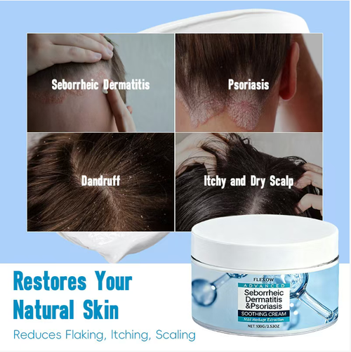 Se você fizer um pedido hoje, enviaremos um total de 5 caixas de creme suave para cuidados com o couro cabeludo que trata eficazmente caspa e bactérias.  Utiliza uma fórmula herbal com 8 ingredientes,tratando diretamente problemas como dermatite seborreica, caspa e raízes do couro cabeludo secas e coçando.  Ele alivia rapidamente o desconforto e fortalece a barreira do couro cabeludo.  A capacidade é de 100 gramas, grande e fácil de transportar, tornando-a adequada para uso diário.