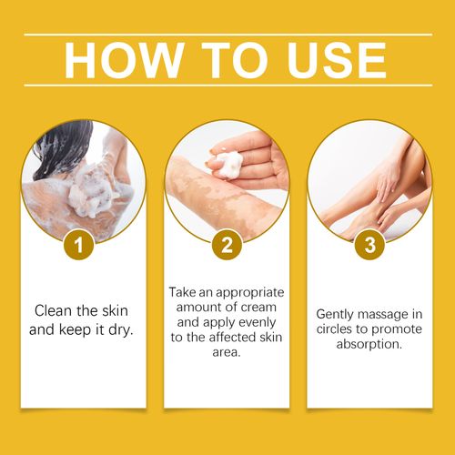 Não perca a oferta exclusiva de hoje! Pegue 3 frascos do Bee Venom Vitiligo Sooing Repair Cream de uma vez. Os ingredientes principais do veneno de abelha nutrem profundamente a base da pele, promovem a regeneração celular e aprimoram a capacidade de autorreparação. Ele age suavemente nas áreas afetadas, desfocando gradualmente as bordas das manchas e uniformizando a pele na pele, sem efeitos colaterais e proporcionando tranquilidade. É um item indispensável para cuidados com a pele.