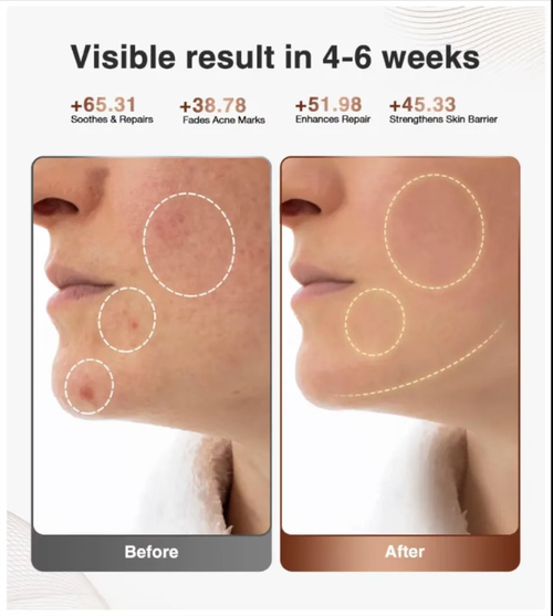 Máscara Espectral Black Flare Stone, com 90% de luz uniforme cobrindo todo o rosto, fototerapia multi-banda para rejuvenescimento direcionado da pele.  Quadro TR-90 + máscara de silicone para os olhos de grau alimentício, confortável sem pressionar o rosto, pode desfrutar de cuidados com a pele enquanto maratona.  15 minutos deitados oferecem um cuidado de nível cinematográfico.  Melhora a opacidade, vermelhidão e queda com um clique.  É a melhor solução para cuidados com a pele preguiçosos!